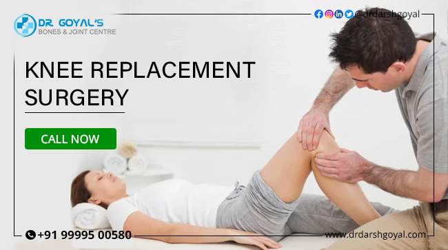 Joint replacement surgery in Delhi - Dr. Darsh Goyal